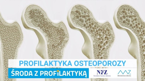Zdjęcie – grafika przedstawiająca przekrój kości w różnych stadiach osteoporozy. Napis – Profilaktyka Osteoporozy, Środa z profilaktyką, logo NFZ i Ministerstwa Zdrowia
