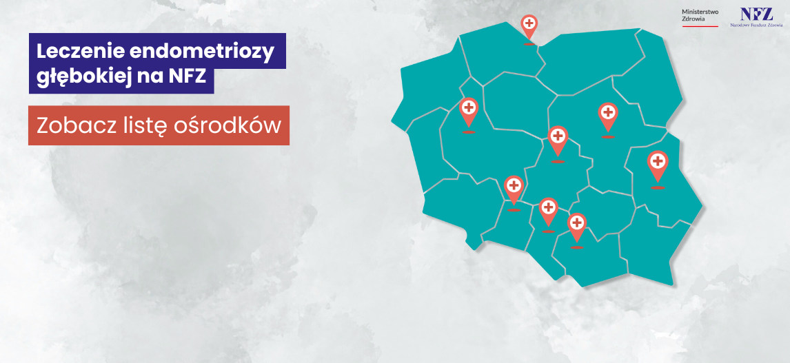 tekst: Leczenie endometriozy gu0142u0119bokiej na NFZ. Zobacz listu0119 ou015brodku00f3w